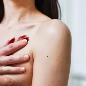 Тромбоцитопения: о чем говорят беспричинные синяки на теле и кровоточивость десен