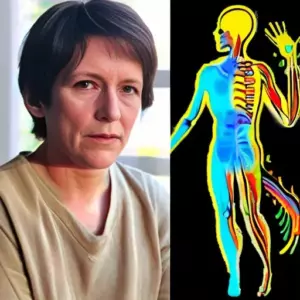 Болезнь Аддисона (бронзовая болезнь): чем опасна хроническая надпочечниковая недостаточность