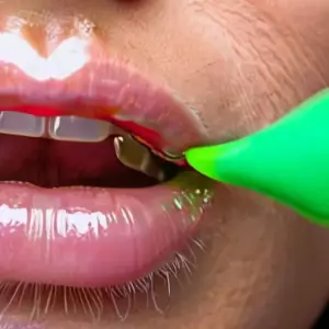 Почему эмаль становится прозрачной и реагирует на холодное: причины гиперчувствительности